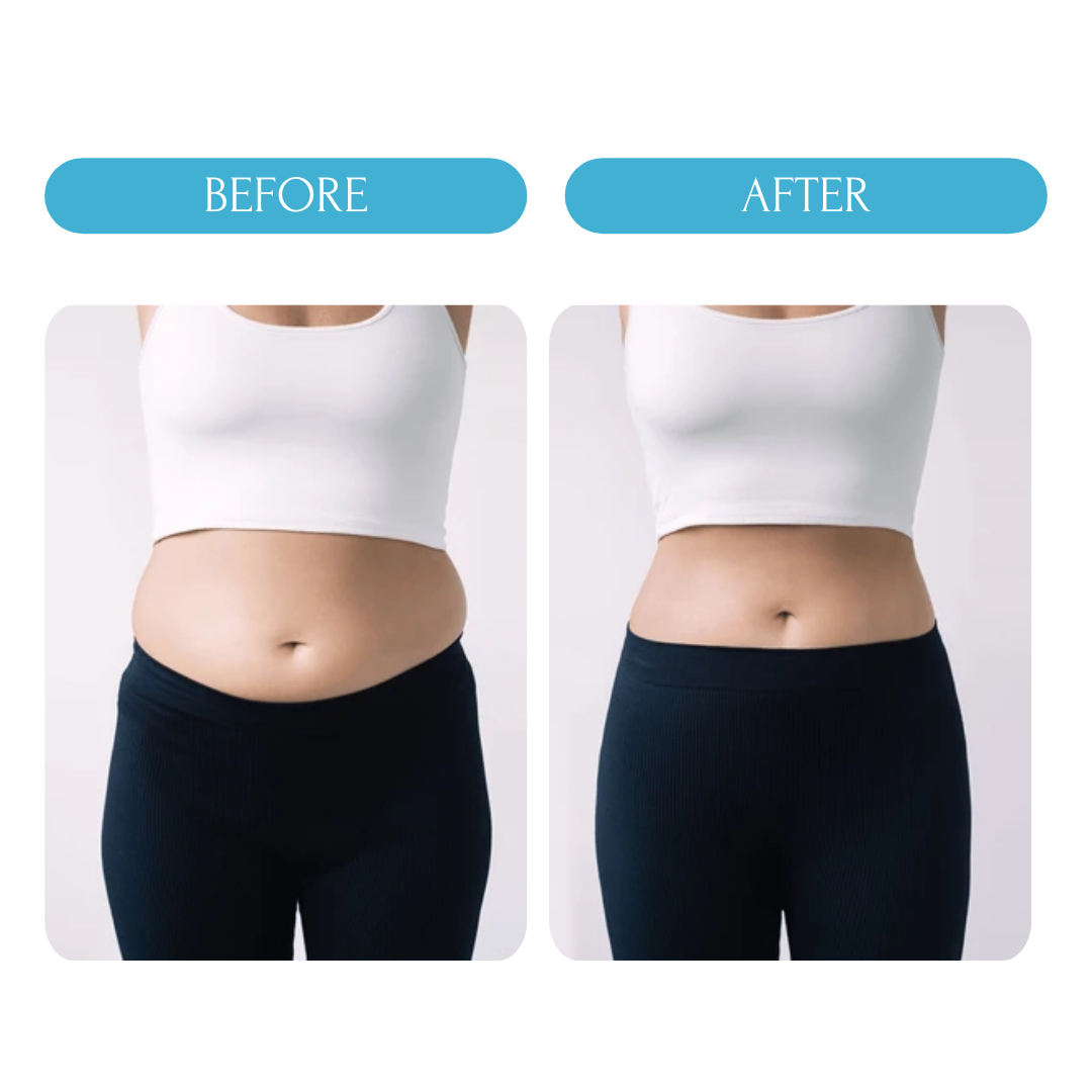 SLIMMING BELLY PADS - 5 PADS